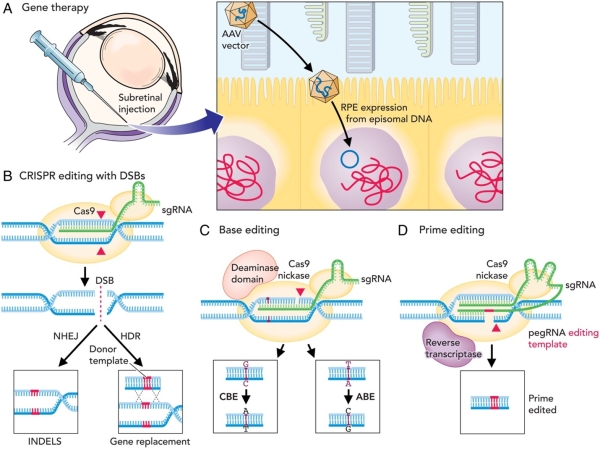 gene therapy