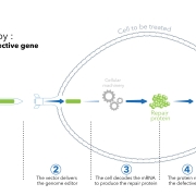 Gene therapy