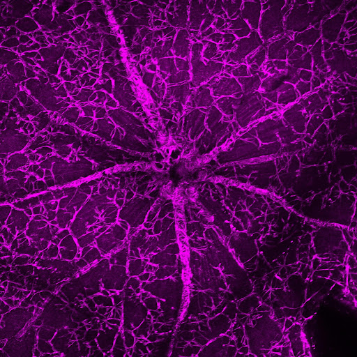Representative single-channel view from the same retinal whole-mount dataset.